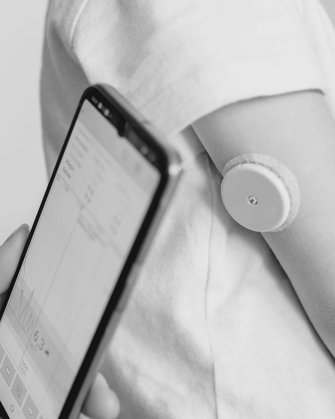 Een glucosesensor op de bovenarm